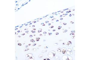 Immunohistochemistry of paraffin-embedded rat bone marrow using ALDOA Rabbit mAb (ABIN7265550) at dilution of 1:100 (40x lens). (ALDOA antibody)