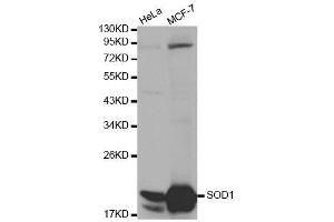 Western blot analysis of extracts of various cell lines, using SOD1 antibody. (SOD1 antibody  (AA 1-154))