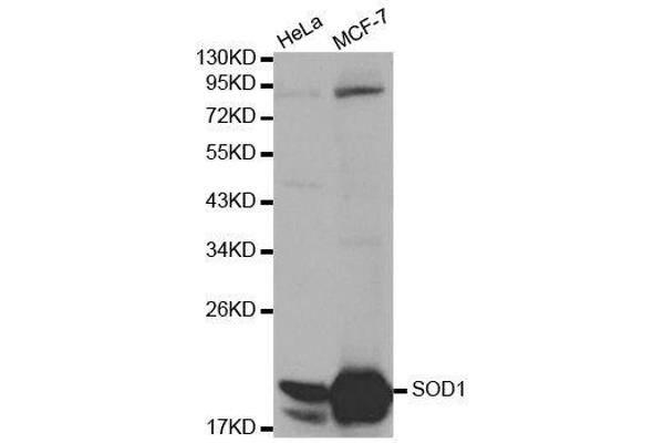 SOD1 抗体  (AA 1-154)