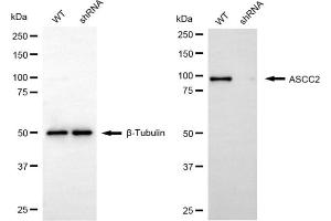 Western blotting analysis using ASCC2 antibody (ABIN7797477). (ASCC2 antibody)