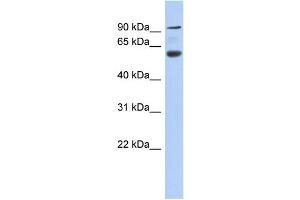 Western Blotting (WB) image for anti-ArfGAP with Coiled-Coil, Ankyrin Repeat and PH Domains 3 (Acap3) (N-Term) antibody (ABIN2784918)