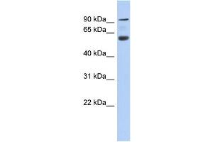 WB Suggested Anti-CENTB5 Antibody Titration: 0. (Acap3 antibody  (N-Term))