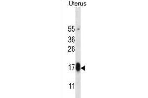 Western Blotting (WB) image for anti-Glycoprotein Hormone beta 5 (GPHb5) antibody (ABIN2997225) (GPHB5 antibody)