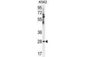 HSD11B1L Antibody Western blot analysis in K562 cell line lysates (35ug/lane). (HSD11B1L antibody  (C-Term))
