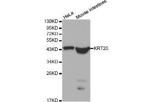 Western blot analysis of extracts of various cell lines, using KRT20 antibody. (KRT20 antibody)