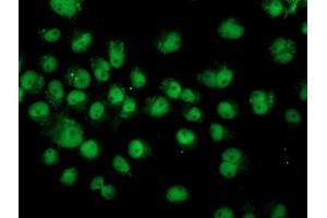 Anti-ASCC1 mouse monoclonal antibody (ABIN2455148) immunofluorescent staining of COS7 cells transiently transfected by pCMV6-ENTRY ASCC1 (RC201872). (ASCC1 antibody)