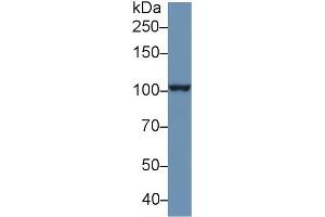 Western Blot; Sample: Human PANC1 cell lysate; Primary Ab: 1µg/ml Rabbit Anti-Human PSA Antibody Second Ab: 0. (NPEPPS antibody  (AA 141-272))