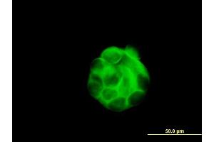Immunofluorescence of monoclonal antibody to SGCB on MCF-7 cell. (SGCB antibody  (AA 87-196))
