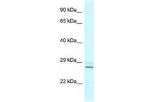 Image no. 1 for anti-Tubulin Polymerization Promoting Protein (Tppp) (N-Term) antibody (ABIN6747493) (Tppp antibody  (N-Term))