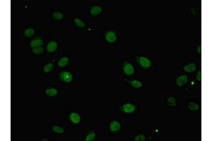Immunofluorescent analysis of A549 cells using ABIN7156394 at dilution of 1:100 and Alexa Fluor 488-congugated AffiniPure Goat Anti-Rabbit IgG(H+L) (INTS1 antibody  (AA 451-710))