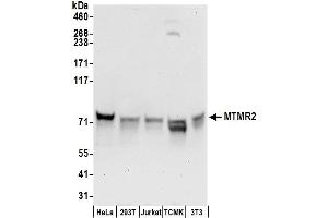 anti-Myotubularin Related Protein 2 (MTMR2) (AA 1-50) antibody