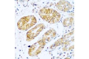 Immunohistochemistry of paraffin-embedded human stomach using NCAM1 antibody. (CD56 antibody  (AA 759-858))