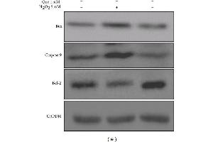 Effects of quercetin on cell apoptosis in H2O2-treated H9C2 cells. (Caspase 9 antibody)