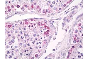 Anti-USP13 antibody IHC of human testis. (USP13 antibody  (AA 500-550))