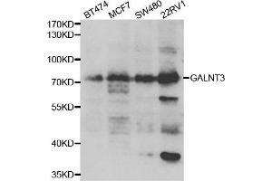 Western blot analysis of extracts of various cell lines, using GALNT3 antibody. (GALNT3 antibody)