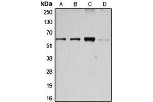 Western blot analysis of Cyclin B1 expression in Jurkat (A), K562 (B), HEK293T (C), HeLa (D) whole cell lysates. (Cyclin B1 antibody  (Center))