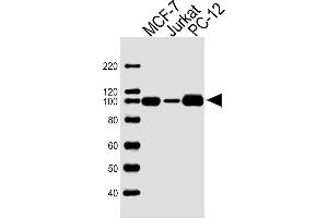 Lane 1: MCF-7 Cell lysates, Lane 2: Sample Tissue/Cell lysates, Lane 3: PC-12 Cell lysates, probed with TOP1 (1291CT875.