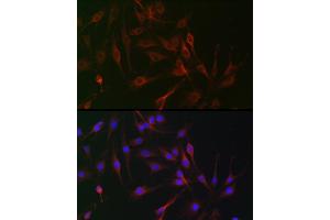Immunofluorescence analysis of C6 cells using IL6ST antibody (ABIN7268003) at dilution of 1:100. (CD130/gp130 antibody  (AA 678-857))