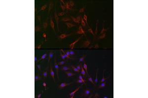 Immunofluorescence analysis of C6 cells using IL6ST antibody (ABIN7268003) at dilution of 1:100. (CD130/gp130 antibody  (AA 678-857))