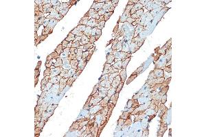 Immunohistochemistry of paraffin-embedded rat heart using Flotillin 1 Rabbit pAb (ABIN6127929, ABIN6140683, ABIN6140684 and ABIN6221813) at dilution of 1:100 (40x lens).