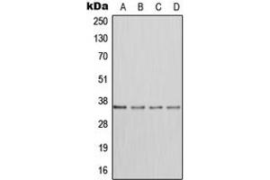 Western blot analysis of DHEA-ST expression in HepG2 (A), HeLa (B), mouse kidney (C), H9C2 (D) whole cell lysates. (SULT2A1 antibody  (Center))