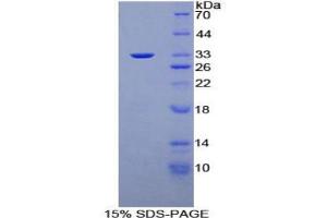SDS-PAGE analysis of Human Protein Kinase N1 Protein.