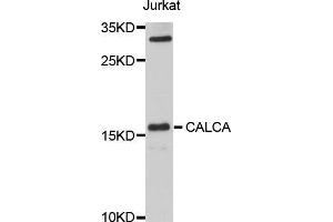 Western blot analysis of extracts of Jurkat cells, using CALCA antibody (ABIN5973226) at 1/1000 dilution. (Calcitonin antibody)
