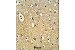 Formalin-fixed and paraffin-embedded human brain tissue reacted with OMD Antibody (C-term), which was peroxidase-conjugated to the secondary antibody, followed by DAB staining. (Osteomodulin antibody  (C-Term))