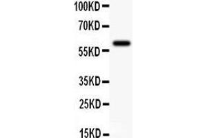 Anti-KCNN antibody,  Western blotting All lanes: Anti KCNN() at 0. (KCNN4 antibody  (N-Term))