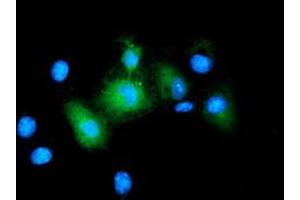 Image no. 2 for anti-Baculoviral IAP Repeat-Containing 5 (BIRC5) antibody (ABIN1501247) (Survivin antibody)
