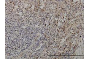 Image no. 2 for anti-GRB2-Related Adaptor Protein 2 (GRAP2) (AA 226-316) antibody (ABIN599077) (GRAP2 antibody  (AA 226-316))