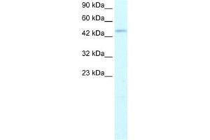 WB Suggested Anti-TFDP2 Antibody Titration:  1. (DP2 antibody  (N-Term))