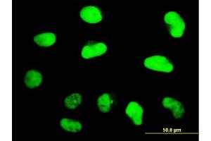 Immunofluorescence of monoclonal antibody to ZNF207 on HeLa cell. (ZNF207 antibody  (AA 1-110))
