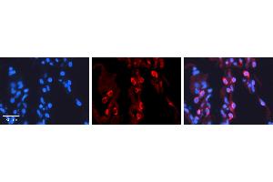 PAPSS2 antibody - C-terminal region          Formalin Fixed Paraffin Embedded Tissue:  Human Lung Tissue    Observed Staining:  Cytoplasm of pneumocytes   Primary Antibody Concentration:  1:100    Secondary Antibody:  Donkey anti-Rabbit-Cy3    Secondary Antibody Concentration:  1:200    Magnification:  20X    Exposure Time:  0. (PAPSS2 antibody  (C-Term))