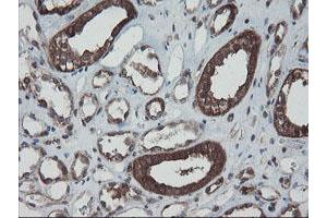 Image no. 12 for anti-SKI-Like Oncogene (SKIL) (AA 307-684) antibody (ABIN1491380)