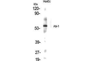 Western Blot (WB) analysis of specific cells using Abi-1 Polyclonal Antibody.