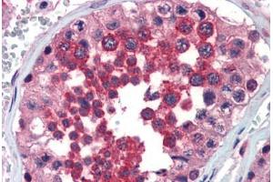 Human Testis (formalin-fixed, paraffin-embedded) stained with FHL1 antibody ABIN462171 followed by biotinylated goat anti-rabbit IgG secondary antibody ABIN481713, alkaline phosphatase-streptavidin and chromogen. (FHL1 antibody  (AA 51-100))