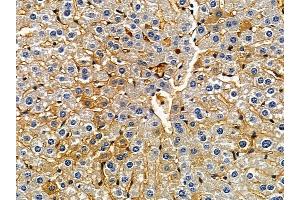 anti-Microtubule-Associated Protein 1 Light Chain 3 gamma (MAP1LC3C) (C-Term) antibody