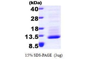 SDS-PAGE (SDS) image for Chemokine (C-X3-C Motif) Ligand 1 (CX3CL1) (AA 25-100) protein (His tag) (ABIN666659)