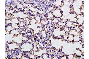Formalin-fixed and paraffin embedded rat lung tissue labeled with Anti-FBP1 Polyclonal Antibody, unconjugated (ABIN752053) at 1:200 followed by incubation with conjugated secondary antibody (FBP1 antibody  (AA 31-130))