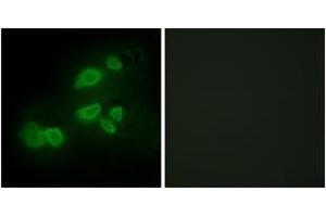 Immunofluorescence analysis of HepG2 cells, using CDCP1 Antibody. (CDCP1 antibody  (AA 691-740))