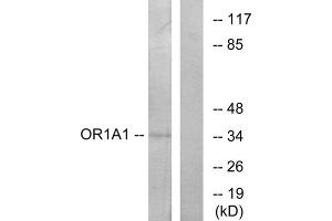 Western blot analysis of extracts from COLO cells, using OR1A1 antibody. (OR1A1 antibody  (C-Term))