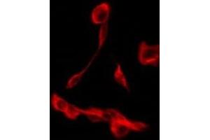 Immunofluorescence (fixed cells) (IF/ICC) image for anti-Solute Carrier Family 9 (Sodium/hydrogen Exchanger), Member 3 Regulator 2 (SLC9A3R2) (Internal Region) antibody (ABIN6259126)