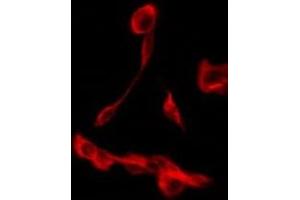 ABIN6275268 staining JK by IF/ICC. (SLC9A3R2 antibody  (Internal Region))