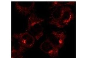 Anti-Rabl Ab at 1/1,000 däution, 293HEK transfectcd tysate at SO µg per Iane, Rabbit polycJonal to goat lµg (HRP) at 1/10,000 dilution. (RAB1A antibody  (C-Term))