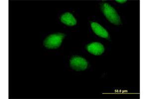 Immunofluorescence of purified MaxPab antibody to SUHW1 on HeLa cell. (ZNF280A antibody  (AA 1-542))