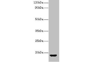 Western blot All lanes: AVP antibody at 2 μg/mL + Rat gonadal tissue Secondary Goat polyclonal to rabbit IgG at 1/10000 dilution Predicted band size: 18 kDa Observed band size: 18 kDa (Vasopressin antibody  (AA 126-164))
