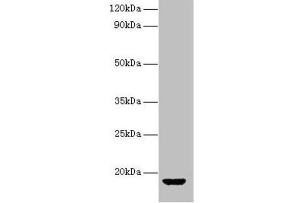 Vasopressin Antikörper  (AA 126-164)