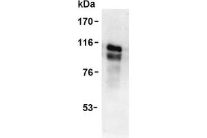 Western Blotting (WB) image for anti-Tumor Necrosis Factor Receptor Superfamily, Member 8 (TNFRSF8) antibody (ABIN492585) (TNFRSF8 antibody)