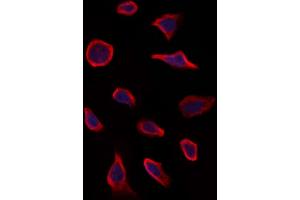ABIN6263303 and ABIN6273267 staining Hela by IF/ICC. (MMP28 antibody  (Internal Region))